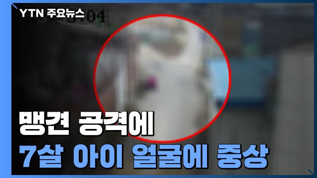 또 개물림 사고...맹견 공격에 7살 아이 얼굴에 중상 / YTN