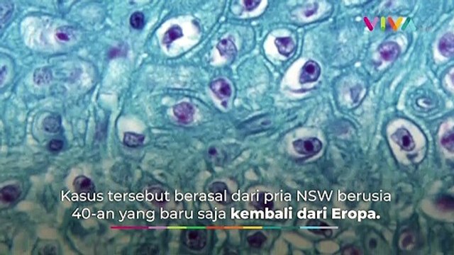 Australia Umumkan Kasus Pertama Virus Cacar Monyet