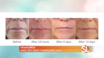 Ready to look younger? VitalityMDs Aesthetics introduces NEW aesthetic laser
