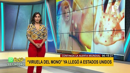 ¡Alerta! EEUU detecta el primer caso de “Viruela del mono” en su territorio