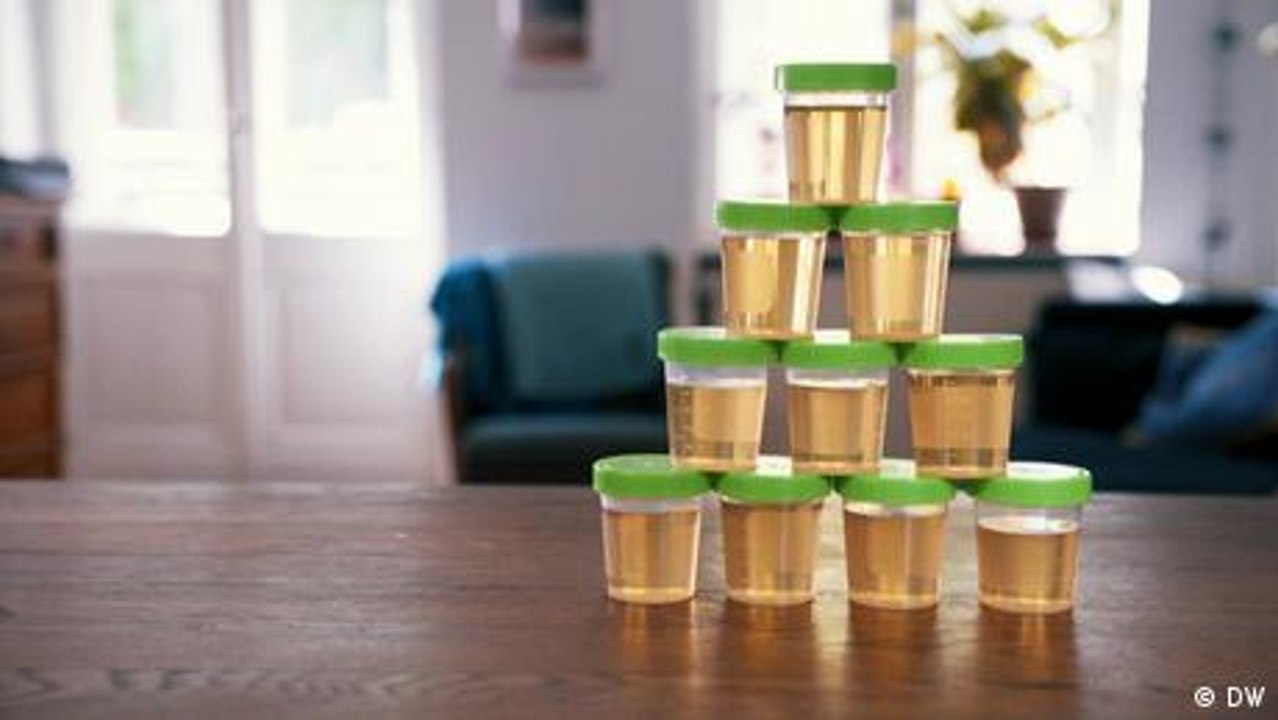 Macht eine Eigenurintherapie schön und gesund?