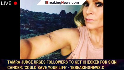 Tamra Judge Urges Followers to Get Checked for Skin Cancer: 'Could Save Your Life' - 1breakingnews.c