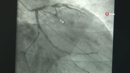 Daha az acı ve kesiyle yapılan bypass yöntemi: Minimal İnvaziv