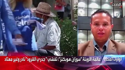 أستاذ مناعة: لا يوجد لقاح مخصص ضد جدري القرود.. والمتاح يحمي بنسبة 85%