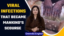 Monkeypox cases outbreaks in 11 countries, Know some of the deadliest diseases | Oneindia News