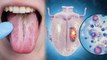जीभ पर सफेद दाग होना Pre Cancer और Tongue Cancer Symptoms | जीभ पर सफेद दाग क्यों होता है |Boldsky