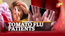 Tomato Flu: Bhubaneswar AIIMS Receiving Patients With Symptoms