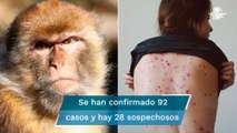 Reportan casos de viruela del mono en 12 países; OMS anticipa que aparecerán más casos