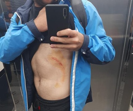 Amatör maçta saha boks ringine döndü 4 futbolcu yaralandı