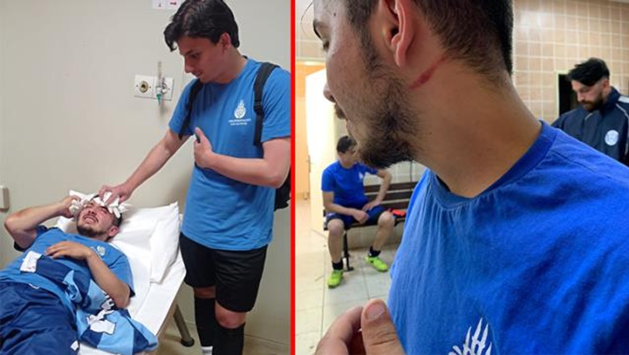 Maç sonu futbolcular birbirine girdi! Ringe dönen sahada 4 sporcu tekme tokat dayak yedi