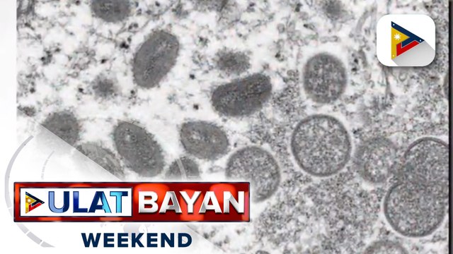 Alamin: Mga sintomas ng Monkeypox at ang kaibahan nito sa COVID-19