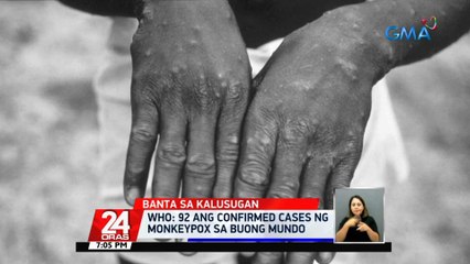 Sec. Duque: hindi pa dapat gawin sa ngayon ang pagsasara ng border ng bansa | 24 Oras