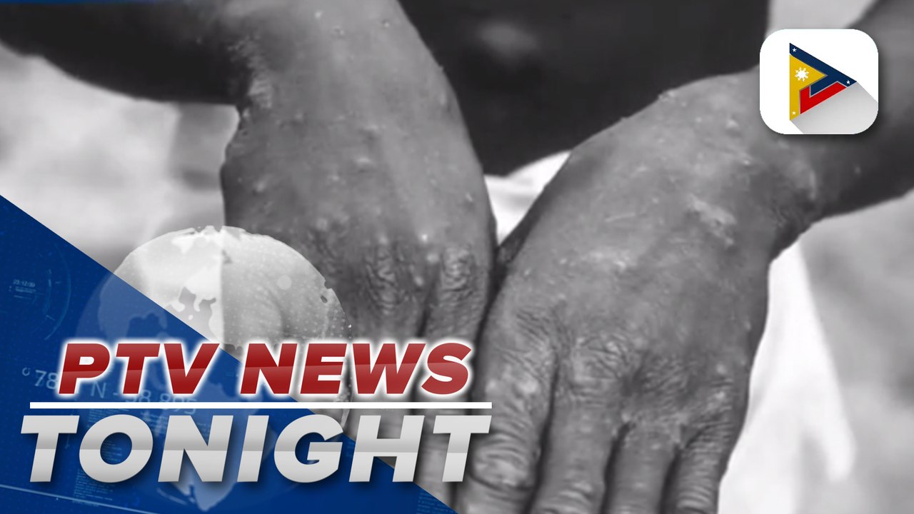 Monkeypox poses new threat to PH; WHO says 12 countries have recorded Monkeypox cases