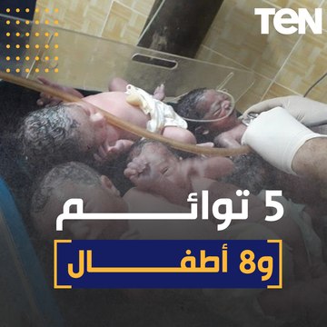 سيدة تلد 5 توأم .. تفاصيل أغرب ولادة في مصر
