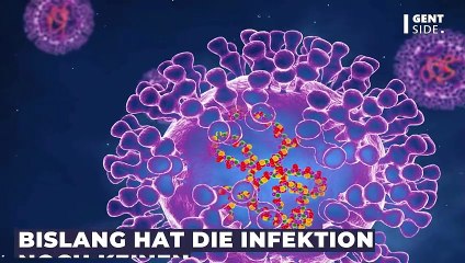 Karl Lauterbachs Affenpocken-Taktik: "Wir müssen hart reagieren, um einen globalen Ausbruch einzudämmen"