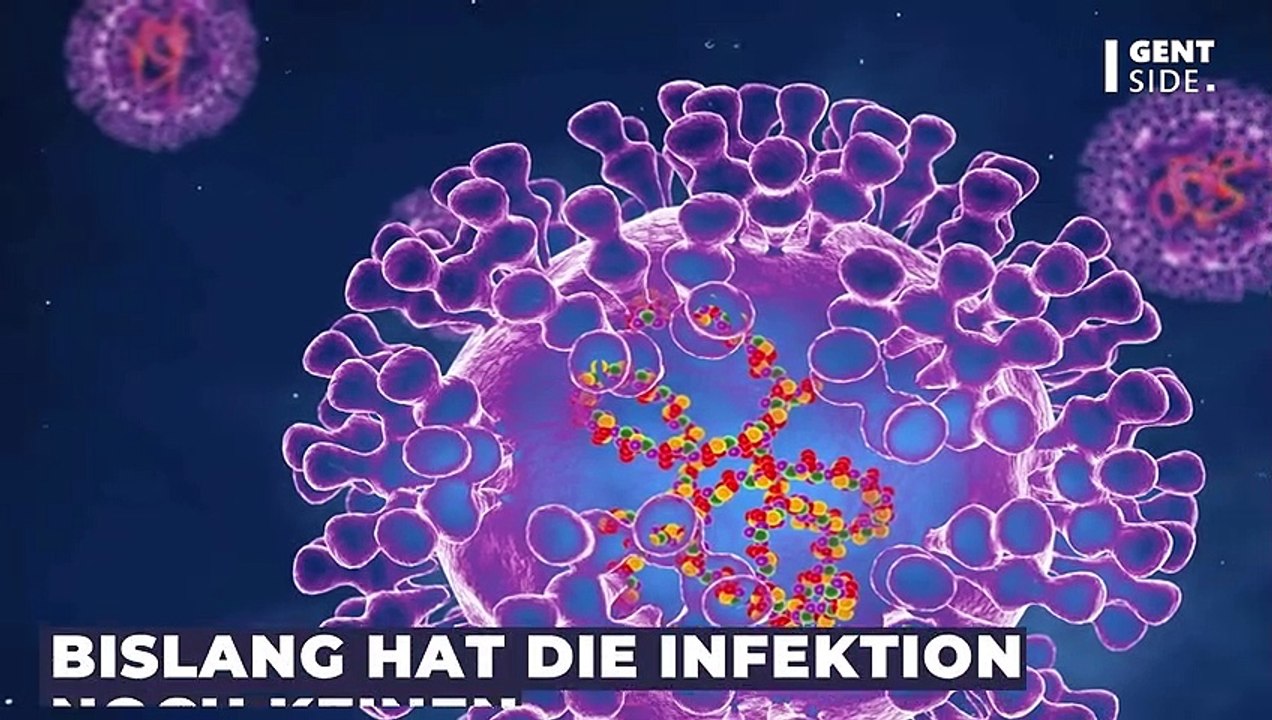 Karl Lauterbachs Affenpocken-Taktik: 'Wir müssen hart reagieren, um einen globalen Ausbruch einzudämmen'