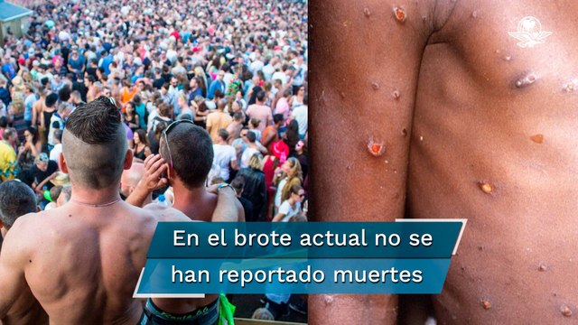 Viruela del mono podría deberse a encuentros sexuales en fiestas masivas en Europa