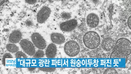 [YTN 실시간뉴스] "대규모 광란 파티서 원숭이두창 퍼진 듯" / YTN