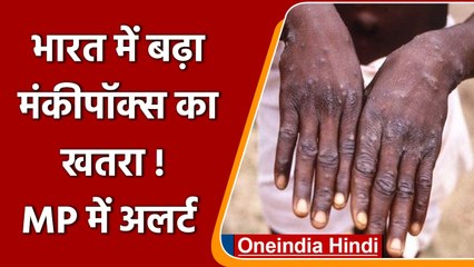 Monkeypox की जकड़ में भारत भी ? Madhya Pradesh में अलर्ट जारी | वनइंडिया हिंदी