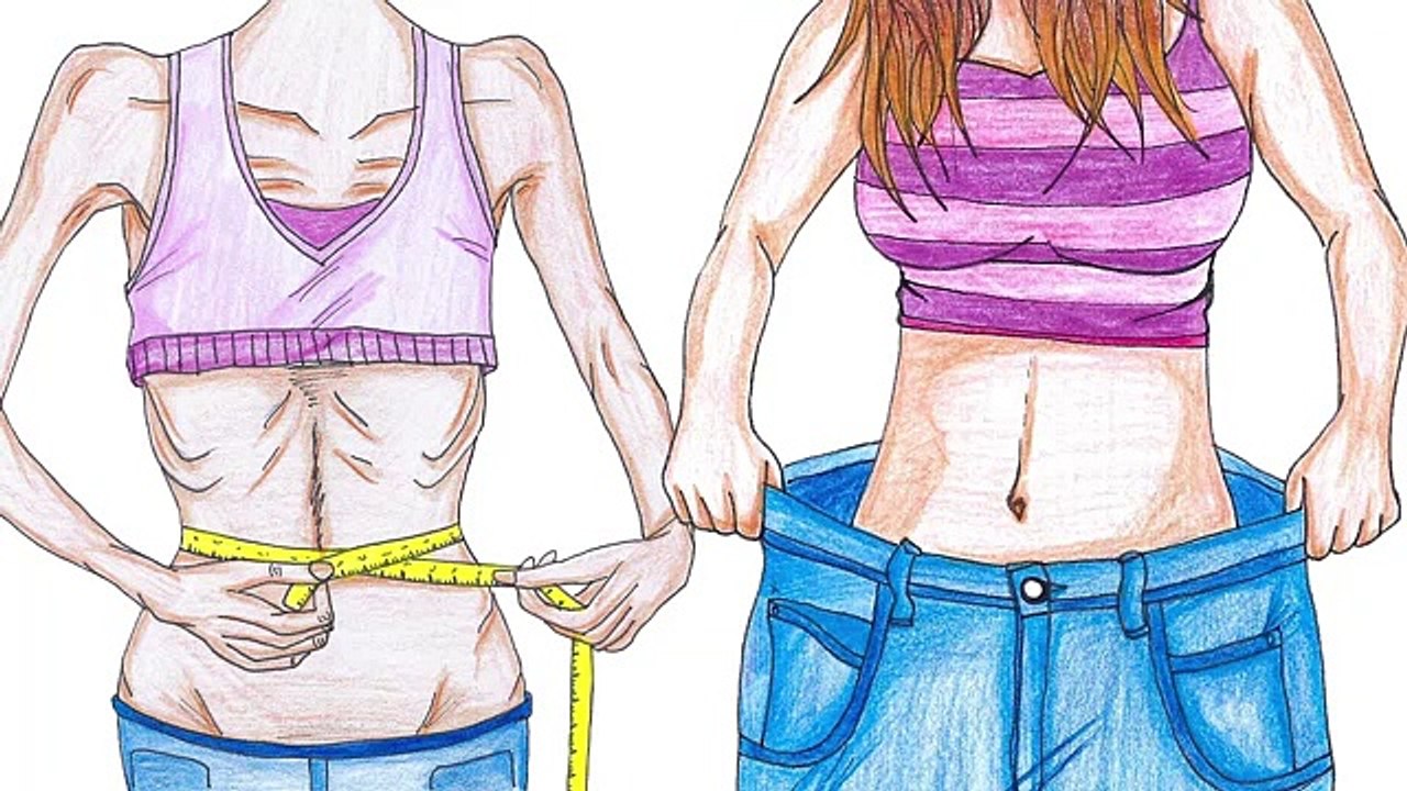 Abnehmen bis zur Magersucht_ Falscher Körperkult als Ursache_ Krankhafter Wunsch dünner zu werden.