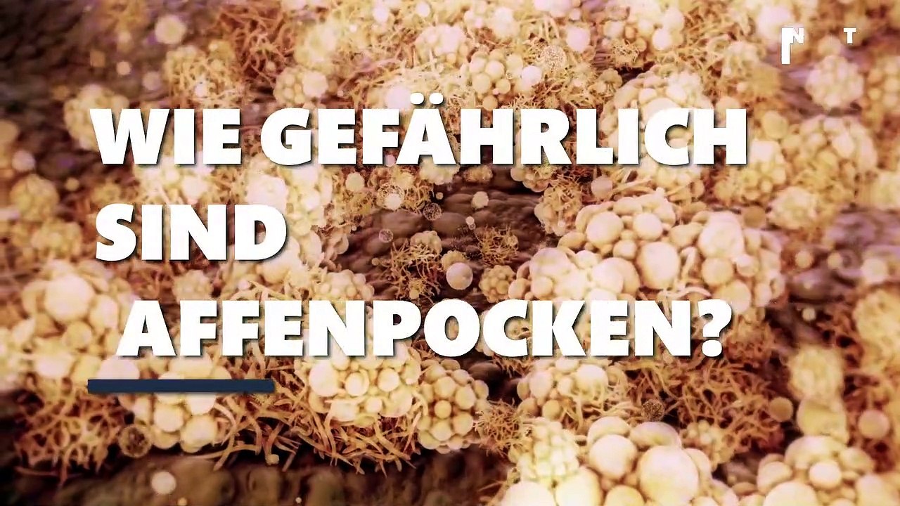 Wie gefährlich sind Affenpocken?