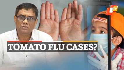 Tomato Flu | Several New Cases Of HFMD Reported Among Children In Odisha
