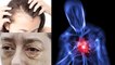 Heart Attack से पहले Face पर Symptoms दिखने पर नजरअंदाज करना जानलेवा MUST WATCH | Boldsky