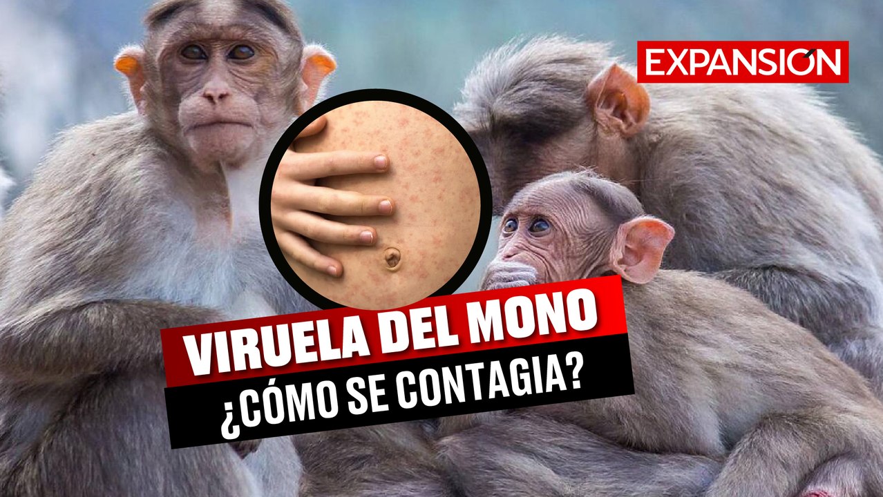 VIRUELA DEL MONO: Qué es, síntomas y cómo se contagia | ÚLTIMAS NOTICIAS