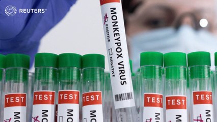 Monkeypox: 21-day quarantine expert recommends