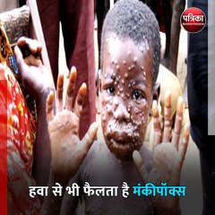 मंकीपॉक्स ने दी दुनिया में दस्तक