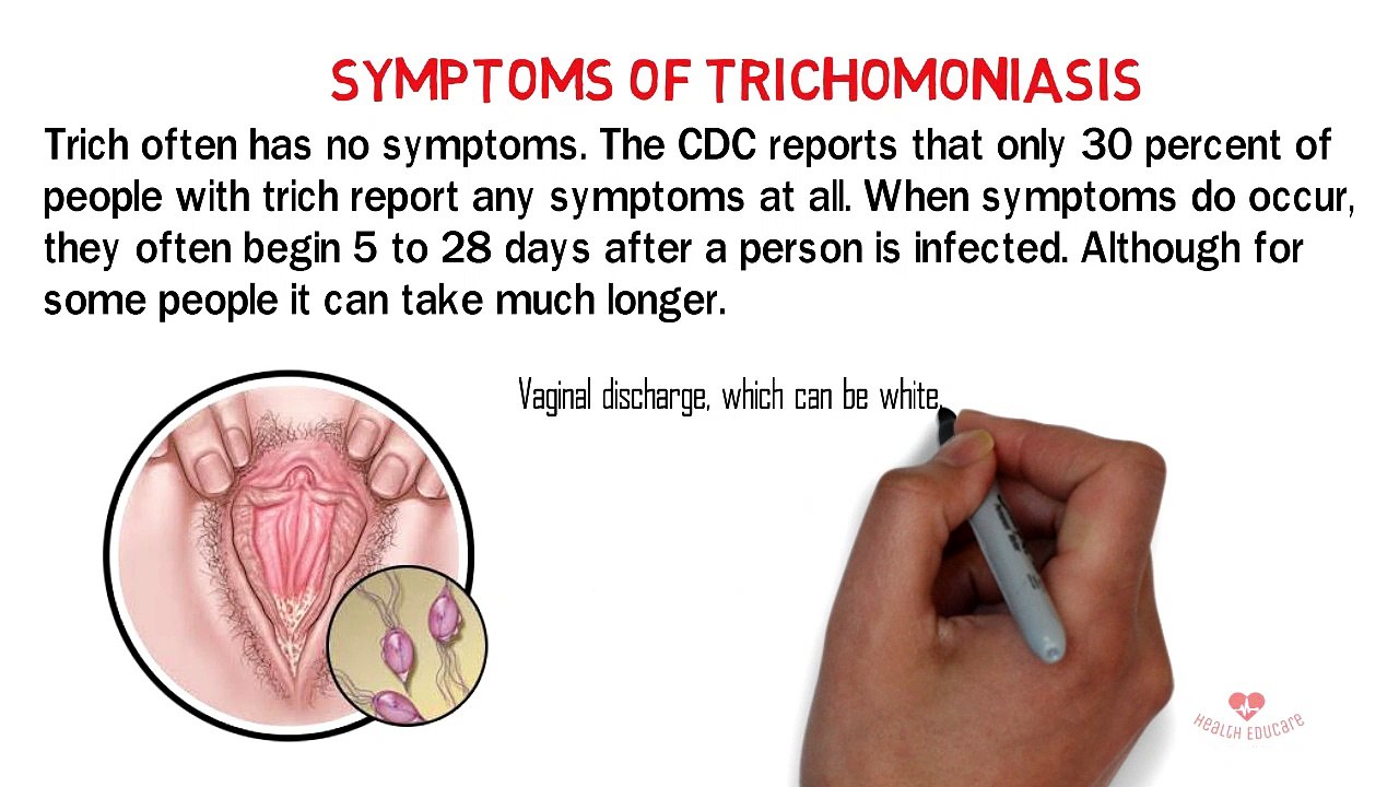 Trichomoniasis - sexually transmitted infectections