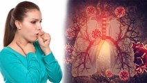 Coughing ज्यादा होना Bronchitis जैसी गंभीर बीमारी, Symptoms चौंकाने वाले । Boldsky