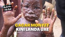 Cacar monyet kini landa UAE