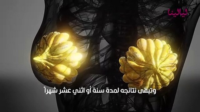 عملية تكبير الثدي بالفيلر