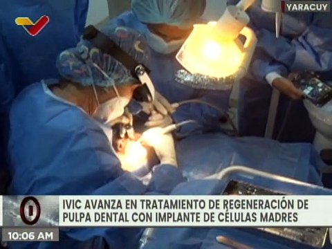 IVIC y Misión Sonrisa aplican tratamientos en medicina regenerativa con células madre en Yaracuy