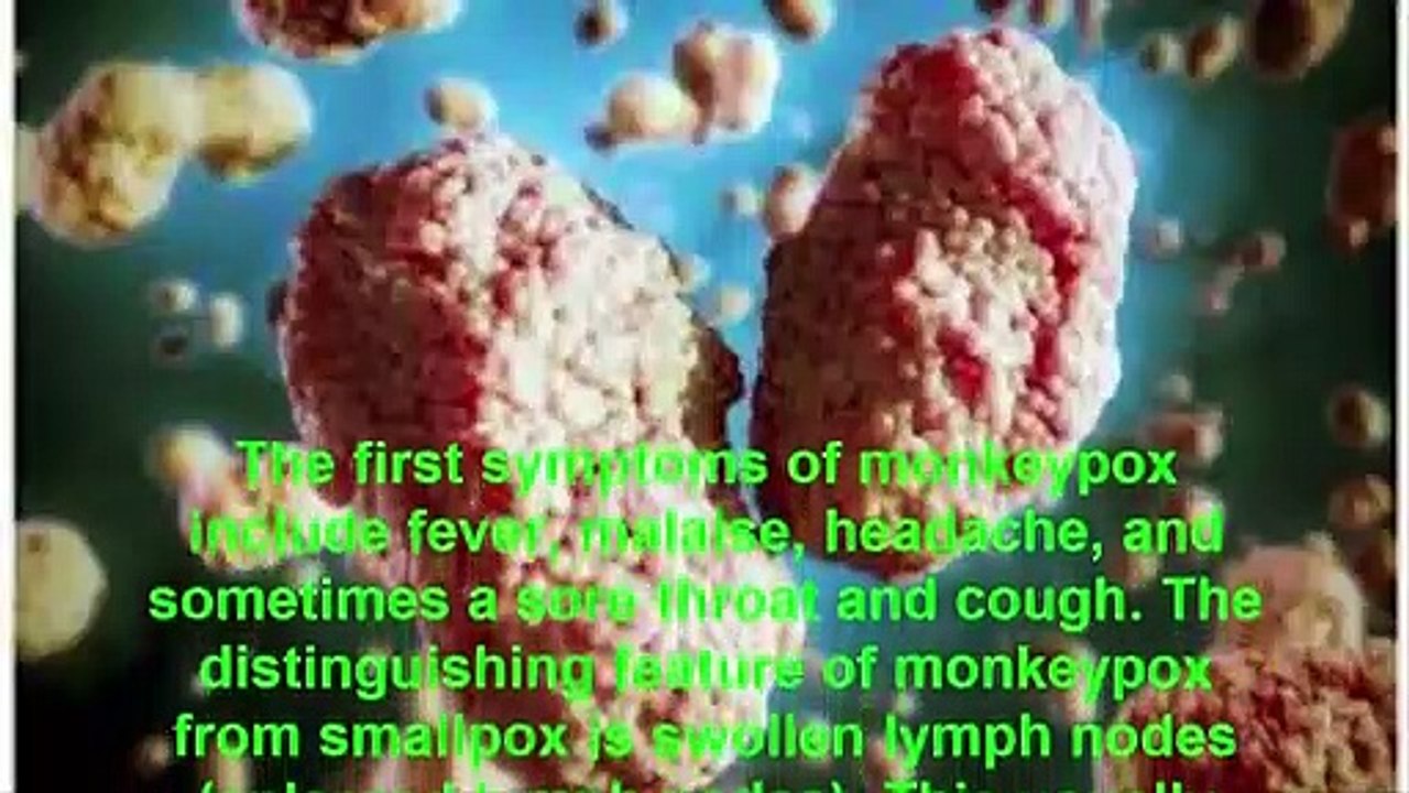 تفشي مرض جدري القردة - مجموعة RT-PCR لفيروس جدري القرود