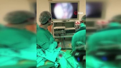 Bir hastaya aynı anda 4 kalp ameliyatı yapıldı