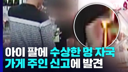 아이 팔에 수상한 멍 자국...가게 아저씨가 찾아낸 아동학대 / YTN