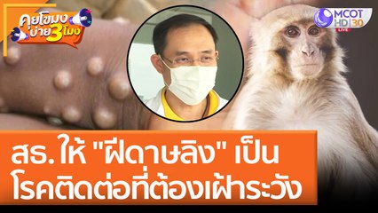 สธ.ให้ "ฝีดาษลิง" เป็นโรคติดต่อที่ต้องเฝ้าระวัง (26 พ.ค. 65) คุยโขมงบ่าย 3 โมง