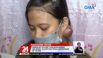 Ginang na 3 taon nang iniinda ang bukol sa kanyang tainga, nanawagan ng tulong | 24 Oras