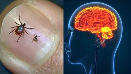 कीड़े के काटने पर Powassan Virus का खतरा, Brain Swelling Symptom ना करें नजरअंदाज | Boldsky