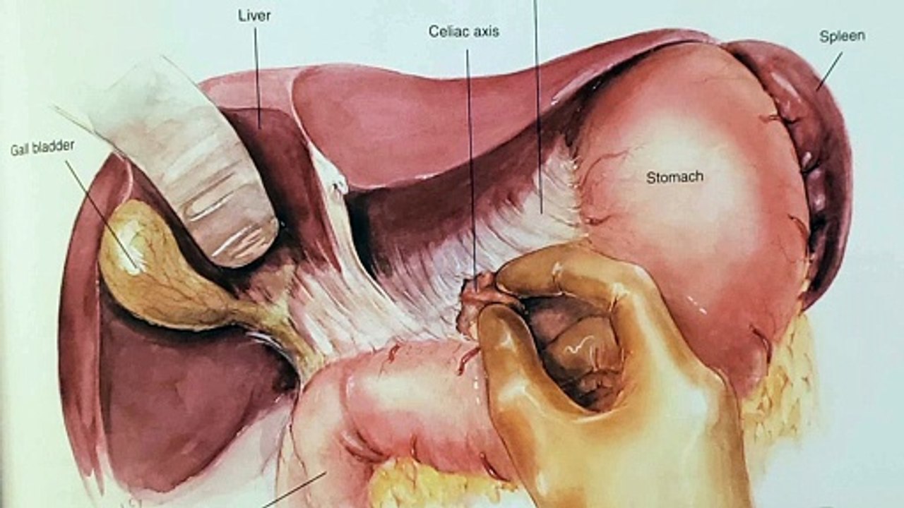 Karim Sarhane Whipple Procedure - step by step