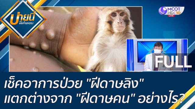(คลิปเต็ม)เช็คอาการป่วย ฝีดาษลิง และแตกต่างจาก ฝีดาษคน อย่างไร!? | บ่ายนี้มีคำตอบ (26 พ.ค. 65)