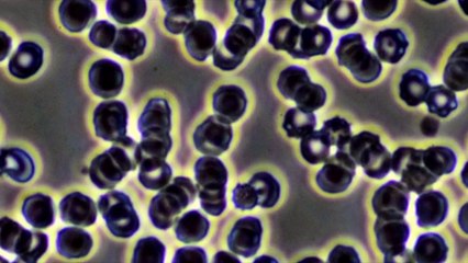 Effekte Von Clo2 Im Blut -1