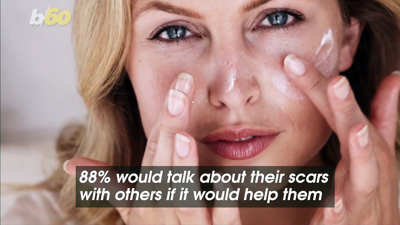 Americans Are Willing to Talk About Their Scars