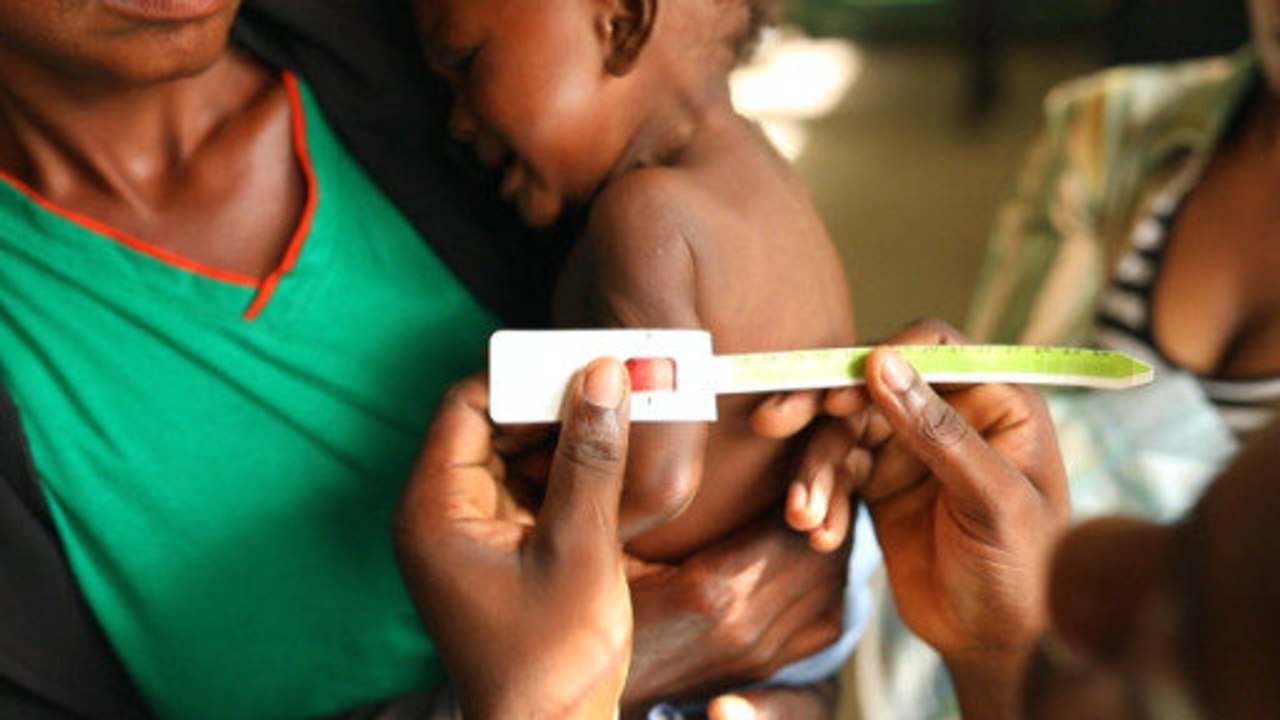 Mangelernährung - versteckter Hunger weltweit