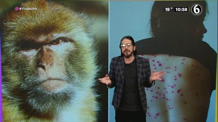 Viruela del mono: qué es y que riesgos presenta para los humanos