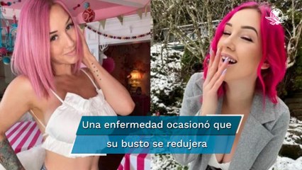 Mamá paga aumento de busto a su hija para subir audiencia en Only Fans