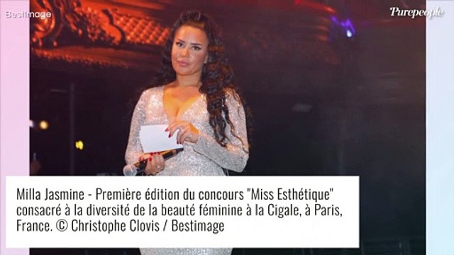 Milla Jasmine succombe encore la chirurgie esthétique : gros changement sur son visage !
