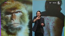 Viruela del mono: qué es y que riesgos presenta para los humanos